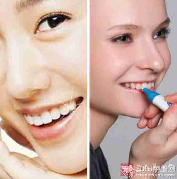 美白牙齿笔 美白牙齿笔